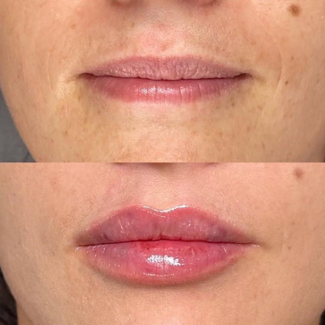 Mini Lip Plump