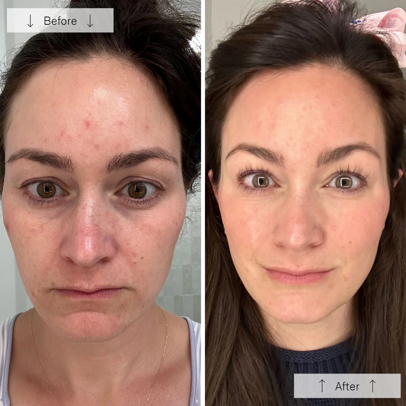 Omnilux Contour Face │ Red light therapy mask