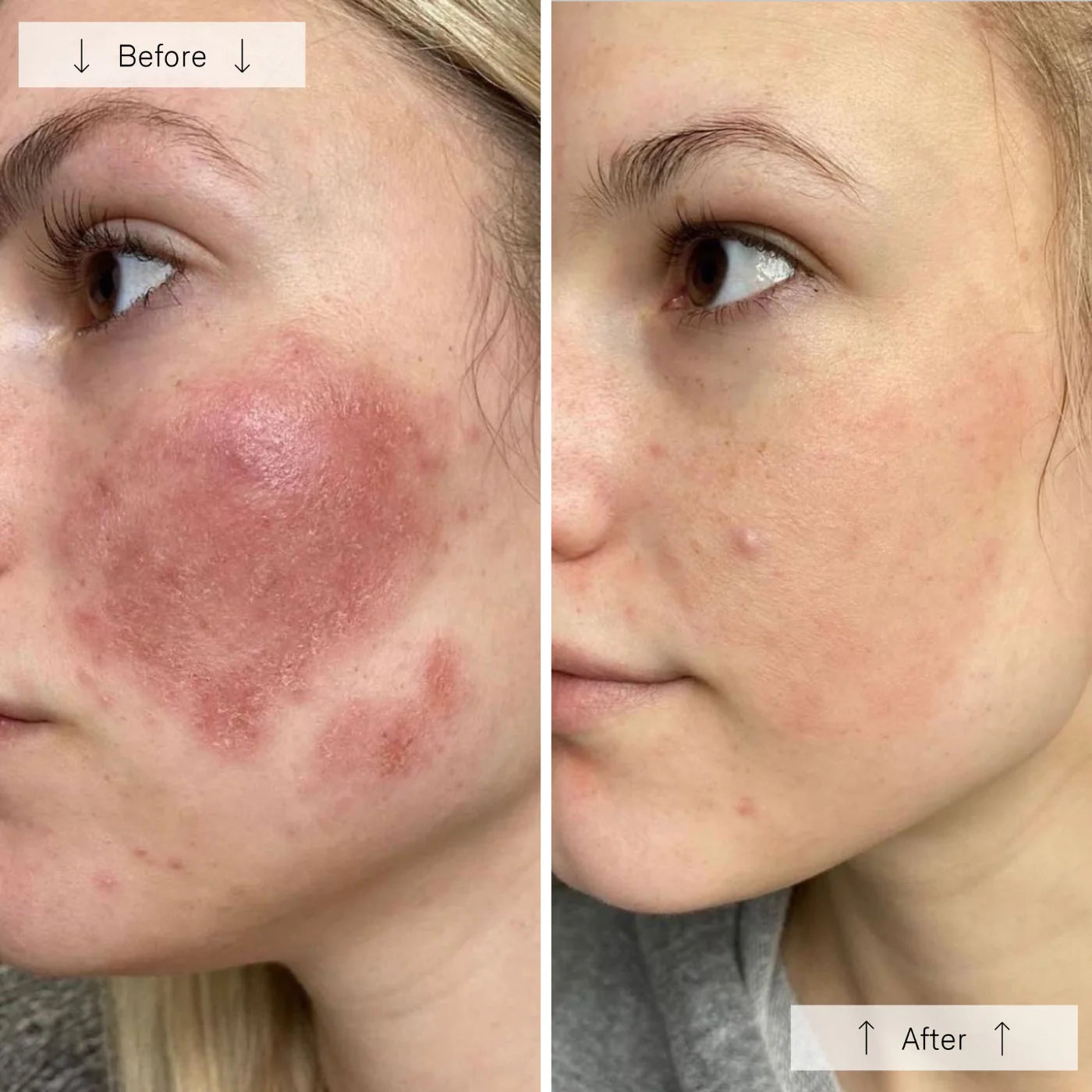 Omnilux Contour Face │ Red light therapy mask