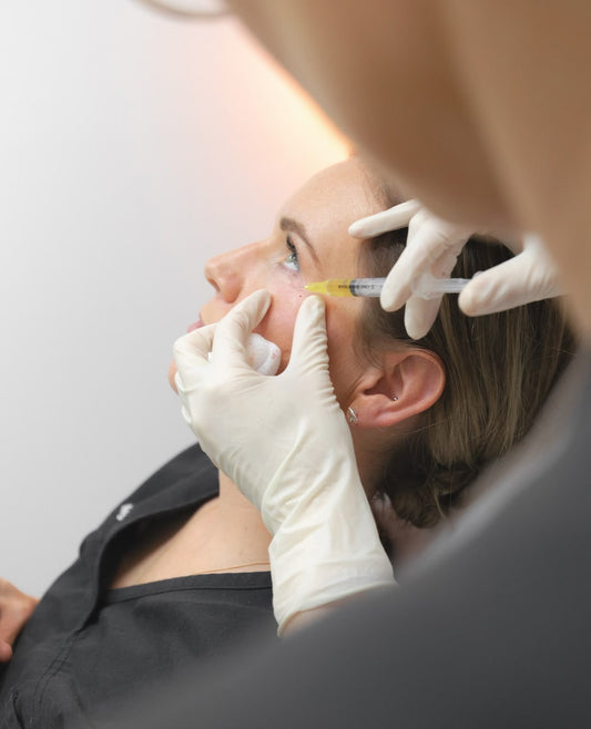PRF Under Eyes