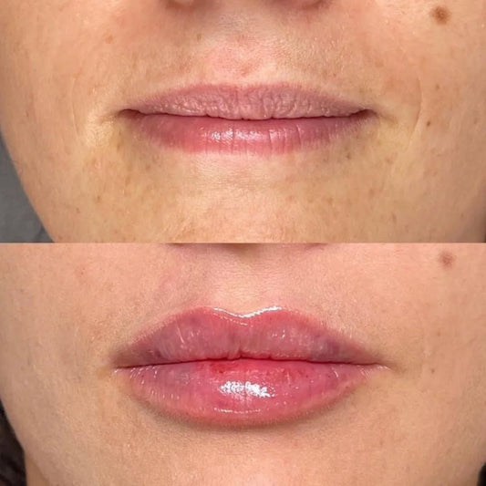 Mini Lip Plump