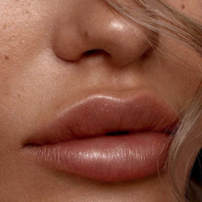 Botox Treatment and Mini Lip plump